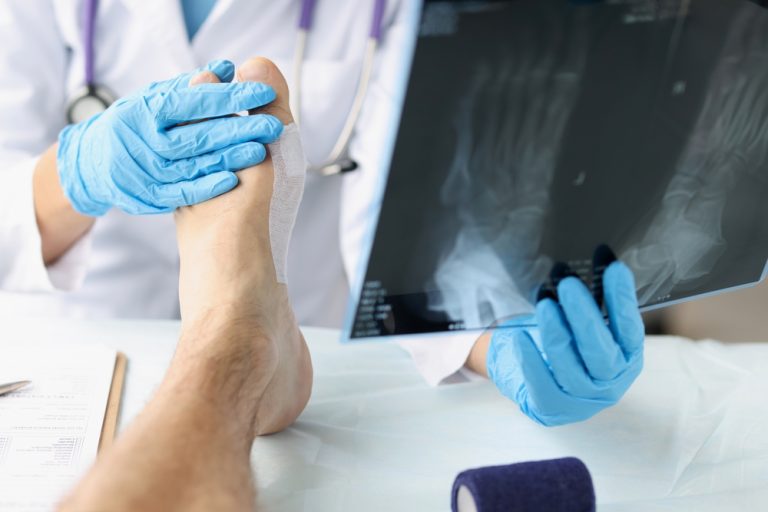 Cartiva Implant Failure Symptoms Reported By Big Toe Surgery Patients in Lawsuits, Social Media and FDA Adverse Events