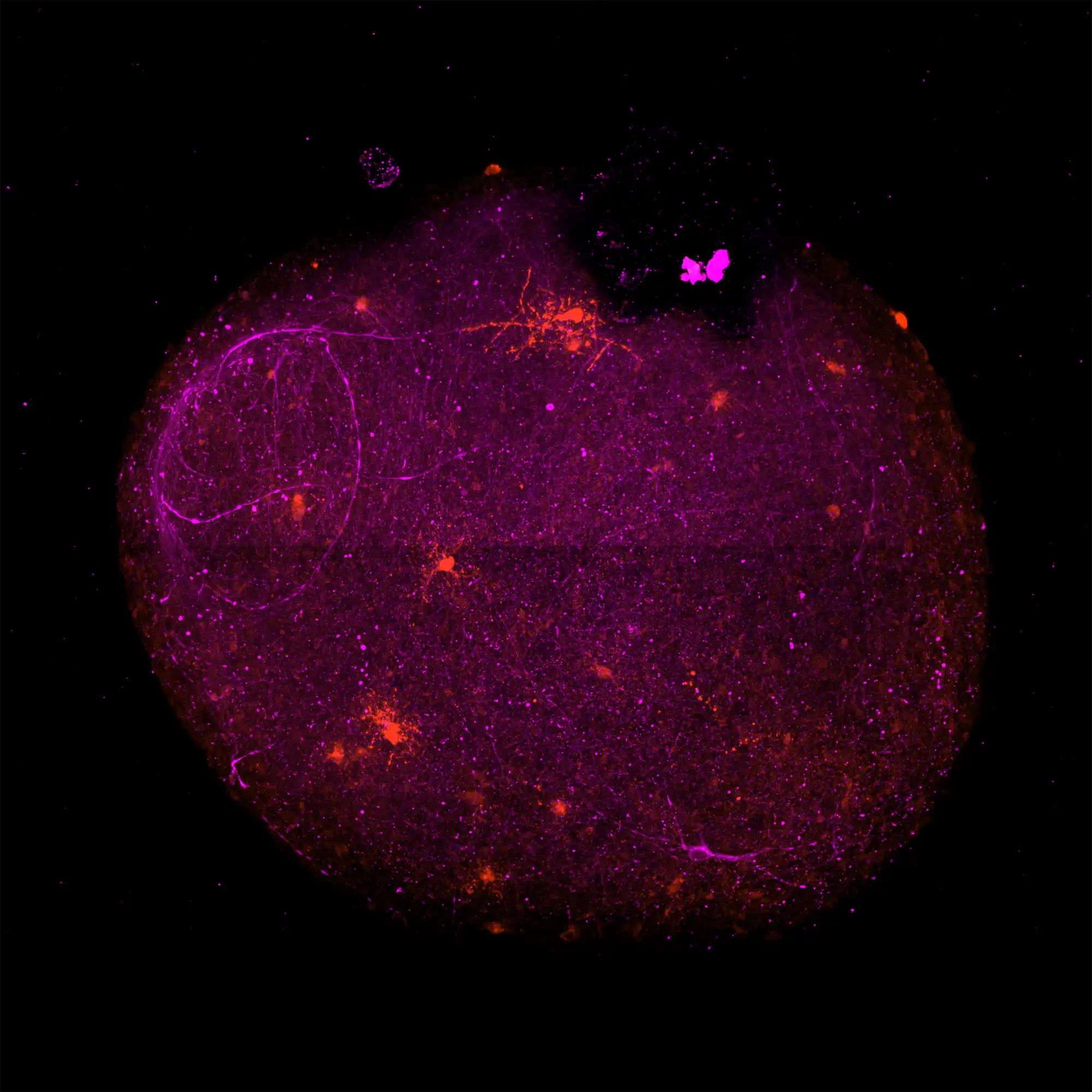 Assessing Myelin Formation and Therapeutic Response Using 3D Organoids